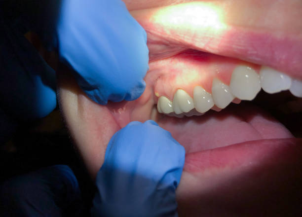 Best Broken or Cracked Tooth Emergency Dentist in Arcola, VA