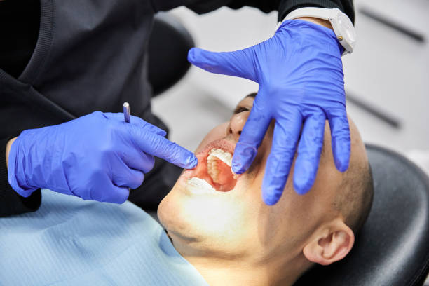 Best Emergency Dental Extractions in Arcola, VA