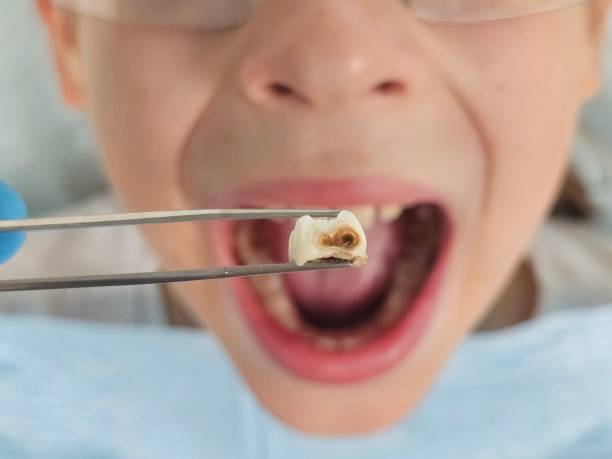 Best Pediatric Emergency Dentist in Arcola, VA